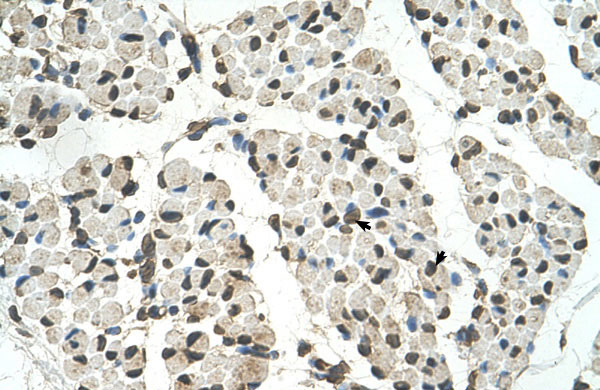 IHC - PSD3 antibody - middle region AI12018