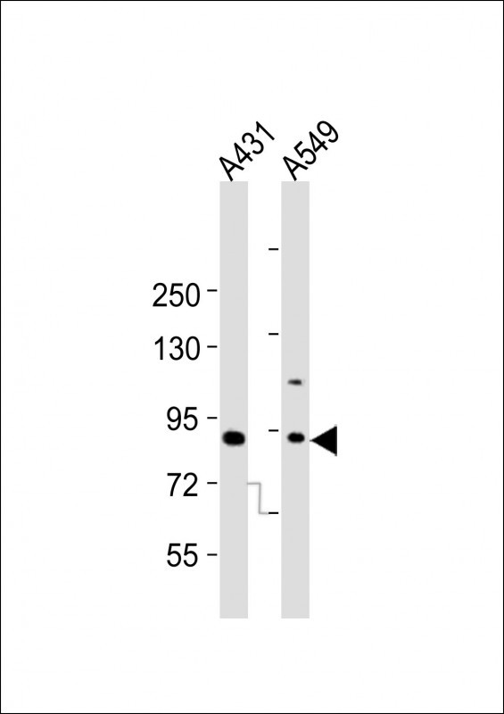 All lanes : Anti-Dnmt3b Antibody (C403) at 1:2000 dilutionLane 1: A431 whole cell lysatesLane 2: A549 whole cell lysatesLysates/proteins at 20 �g per lane. SecondaryGoat Anti-Rabbit IgG,  (H+L), Peroxidase conjugated at 1/10000 dilutionPredicted band size : 95 kDaBlocking/Dilution buffer: 5% NFDM/TBST.