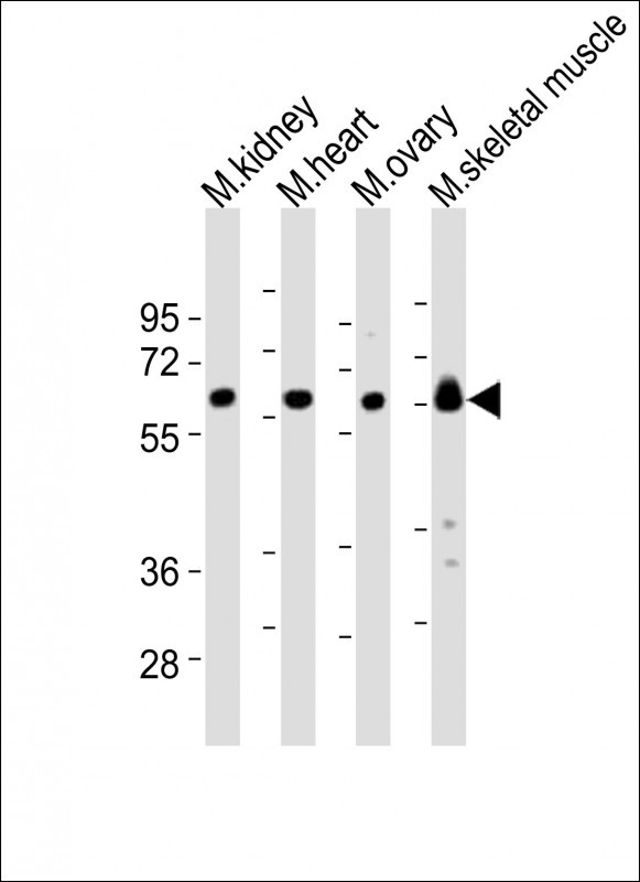 All lanes : Anti-Lyn Antibody (Center) at 1:2000 dilutionLane 1: mouse kidney lysatesLane 2: mouse heart lysatesLane 3: mouse ovary lysatesLane 4: mouse skeletal muscle lysatesLysates/proteins at 20 �g per lane. SecondaryGoat Anti-Rabbit IgG,  (H+L), Peroxidase conjugated at 1/10000 dilutionPredicted band size : 59 kDaBlocking/Dilution buffer: 5% NFDM/TBST.