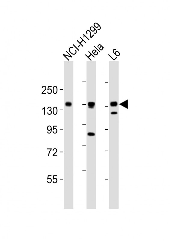 All lanes : Anti-AXL Antibody (C-term) at 1:2000 dilutionLane 1: NCI-H1299 whole cell lysatesLane 2: Hela whole cell lysatesLane 3: L6 whole cell lysatesLysates/proteins at 20 �g per lane. SecondaryGoat Anti-Rabbit IgG,  (H+L), Peroxidase conjugated at 1/10000 dilutionPredicted band size : 98 kDaBlocking/Dilution buffer: 5% NFDM/TBST.