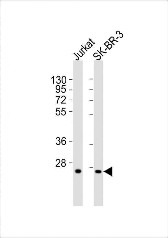 WB - GZMK Antibody (N-Term) AP21412a