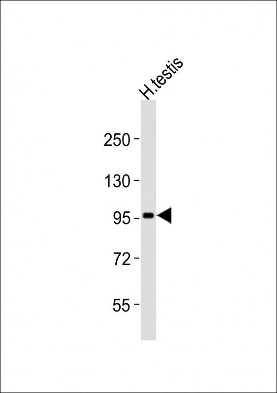 Anti-USP13 Antibody (V404)at  1:2000 dilution + human testis lysatesLysates/proteins at 20 �g per lane. SecondaryGoat Anti-Rabbit IgG,  (H+L), Peroxidase conjugated at 1/10000 dilutionPredicted band size : 97. 3 kDaBlocking/Dilution buffer: 5% NFDM/TBST.