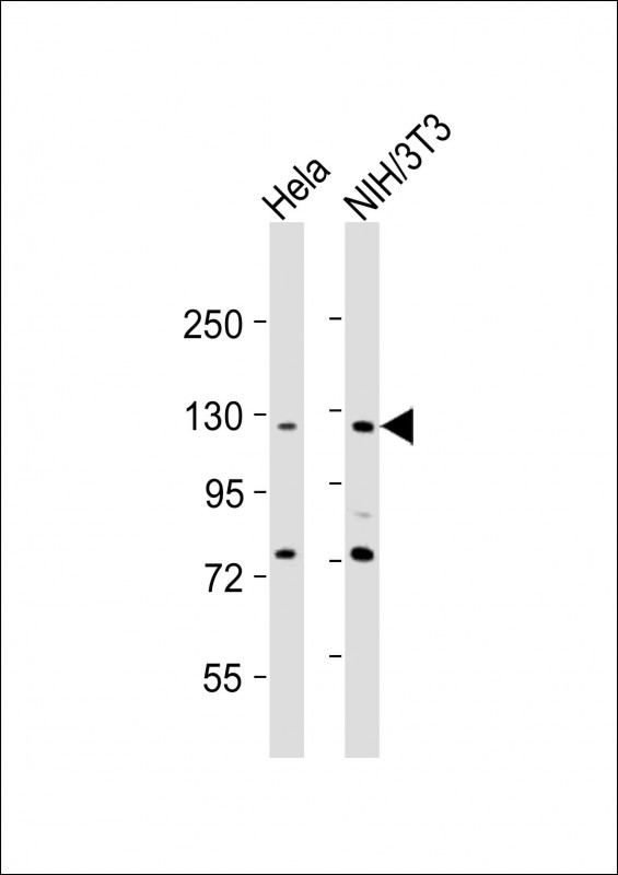 All lanes : Anti-AATK Antibody (N-Term) at 1:2000 dilutionLane 1: Hela whole cell lysatesLane 2: NIH/3T3 whole cell lysatesLysates/proteins at 20 �g per lane. SecondaryGoat Anti-Rabbit IgG,  (H+L), Peroxidase conjugated at 1/10000 dilutionPredicted band size : 145 kDaBlocking/Dilution buffer: 5% NFDM/TBST.