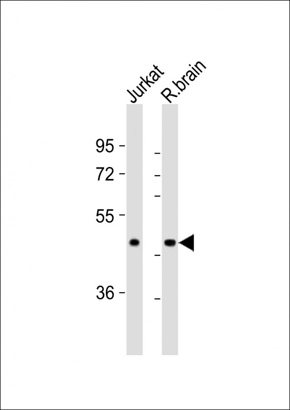 All lanes : Anti-CBX8 Antibody (Center) at 1:8000 dilutionLane 1: Jurkat whole cell lysatesLane 2: rat brain lysatesLysates/proteins at 20 �g per lane. SecondaryGoat Anti-Rabbit IgG,  (H+L), Peroxidase conjugated at 1/10000 dilutionPredicted band size : 43 kDaBlocking/Dilution buffer: 5% NFDM/TBST.