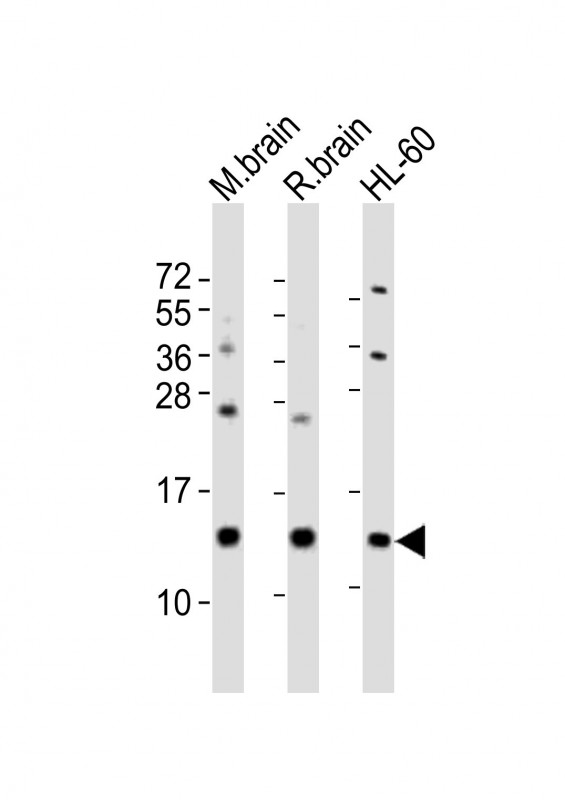 All lanes : Anti-FKBP1A Antibody (Center) at 1:2000 dilutionLane 1: mouse brain lysatesLane 2: rat brain lysatesLane 3: HL-60 whole cell lysatesLysates/proteins at 20 �g per lane. SecondaryGoat Anti-Rabbit IgG,  (H+L), Peroxidase conjugated at 1/10000 dilutionPredicted band size : 12 kDaBlocking/Dilution buffer: 5% NFDM/TBST.