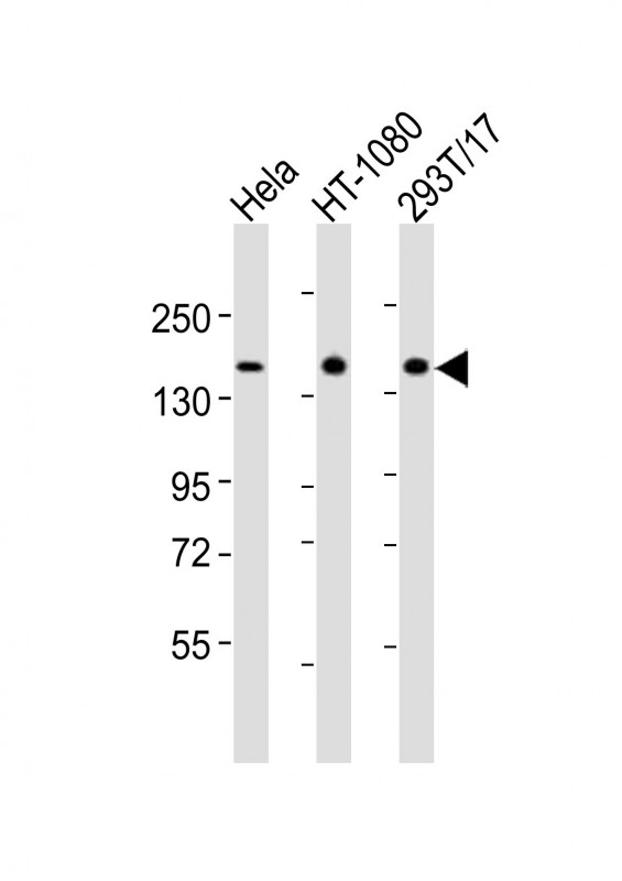 All lanes : Anti-RAPGEF2 Antibody (C-term) at 1:2000 dilutionLane 1: Hela whole cell lysatesLane 2: HT-1080 whole cell lysatesLane 3: 293T/17 whole cell lysatesLysates/proteins at 20 �g per lane. SecondaryGoat Anti-Rabbit IgG,  (H+L), Peroxidase conjugated at 1/10000 dilutionPredicted band size : 167 kDaBlocking/Dilution buffer: 5% NFDM/TBST.