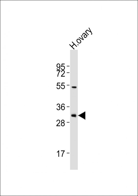 WB - NBPF12 Antibody (Center) AP21456c