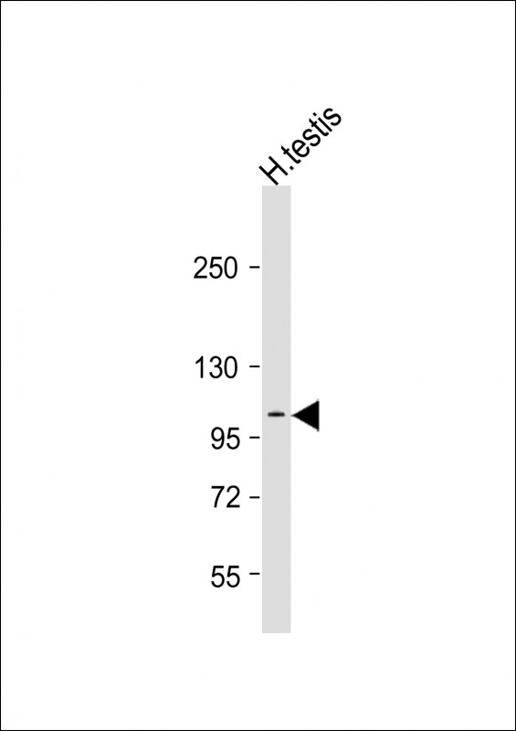 Anti-AQPEP Antibody (C-Term)at  1:2000 dilution + human testis lysatesLysates/proteins at 20 �g per lane. SecondaryGoat Anti-Rabbit IgG,  (H+L), Peroxidase conjugated at 1/10000 dilutionPredicted band size : 113 kDaBlocking/Dilution buffer: 5% NFDM/TBST.