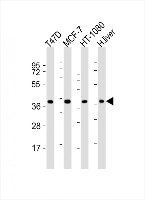 All lanes : Anti-ACBD4 Antibody (Center) at 1:2000 dilutionLane 1: T47D whole cell lysatesLane 2: MCF-7 whole cell lysatesLane 3: HT-1080 whole cell lysatesLane 4: human liver lysatesLysates/proteins at 20 �g per lane. SecondaryGoat Anti-Rabbit IgG,  (H+L), Peroxidase conjugated at 1/10000 dilutionPredicted band size : 30 kDaBlocking/Dilution buffer: 5% NFDM/TBST.