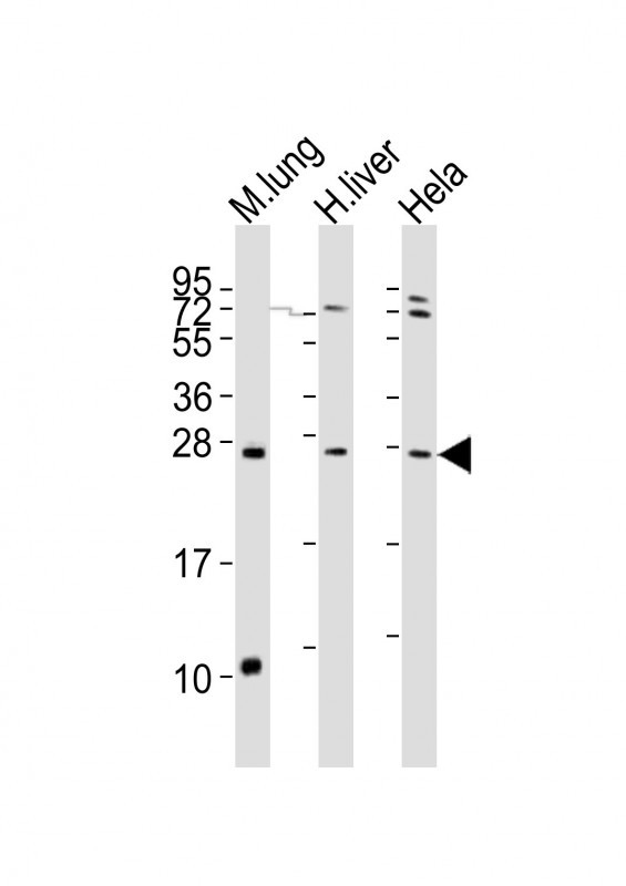 WB - SOST Antibody (N-term) AP6261A
