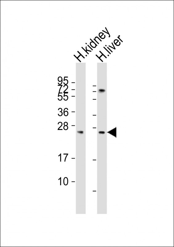 WB - SOST Antibody (N-term) AP6261A