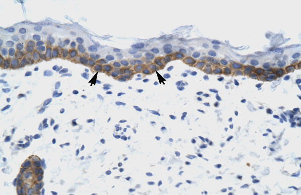 IHC - NUDT9 antibody - C-terminal region AI12027