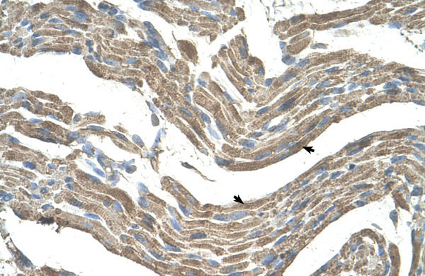 IHC - ASPN antibody - middle region AI12107