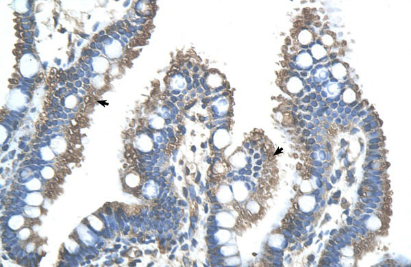 IHC - RNF121 antibody - N-terminal region AI12246