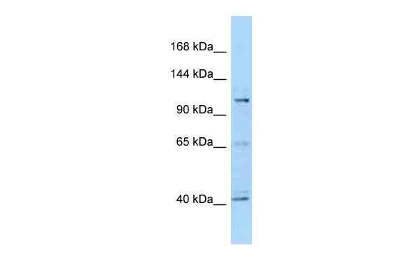 WB - Hdac4 Antibody - C-terminal region AI12303