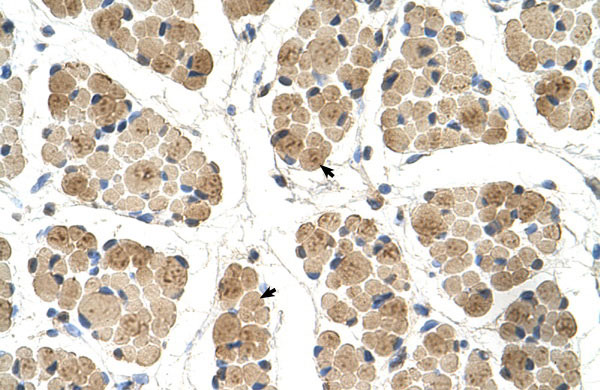 IHC - KLHL31 antibody - C-terminal region AI12430