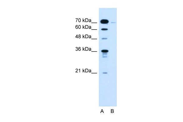 WB - KLHL31 antibody - C-terminal region AI12430