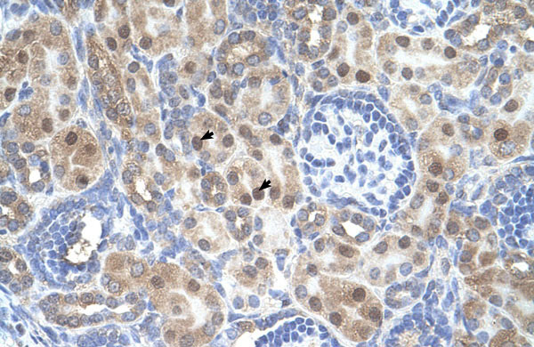 IHC - ARMCX6 antibody - N-terminal region AI12452