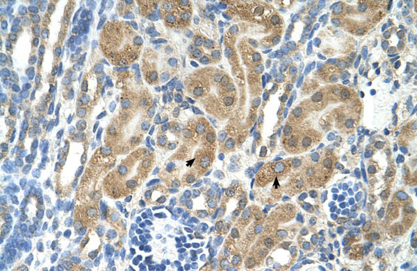 IHC - PARL antibody - N-terminal region AI12508