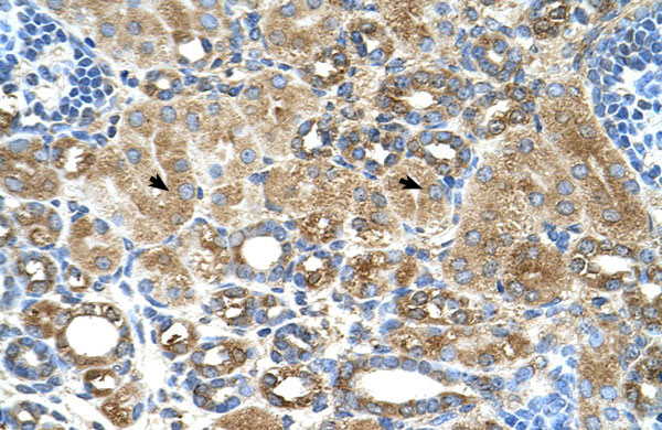 IHC - UBXD2 antibody - middle region AI12820