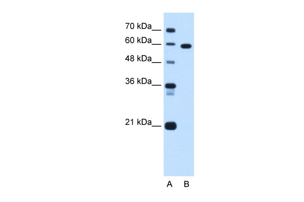 WB - TBX15 antibody - C-terminal region AI12836