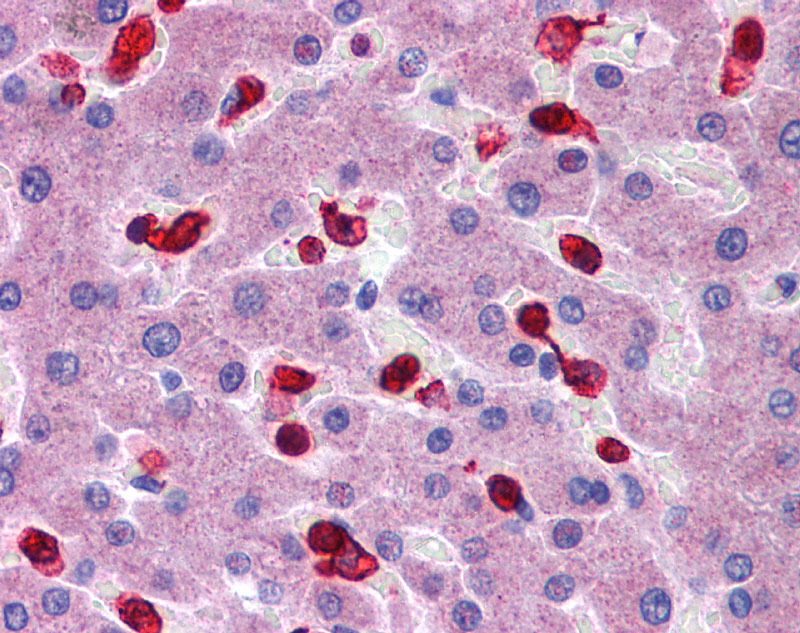 IHC - PRDX2 antibody - middle region AI12896