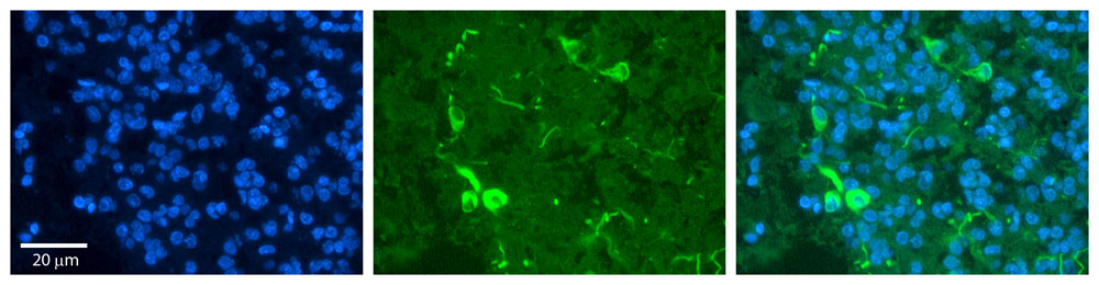 IHC - PRDX2 antibody - middle region AI12896