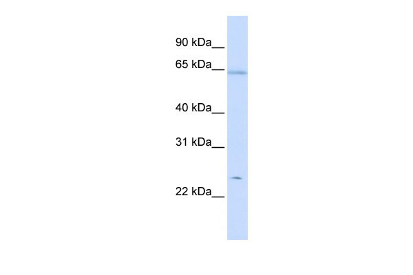 WB - PRDX2 antibody - middle region AI12896