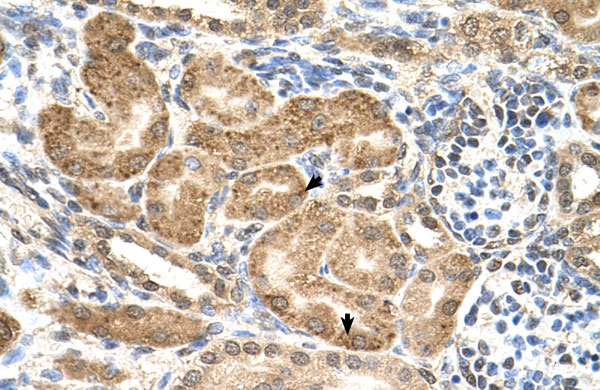 IHC - GMPPB antibody - C-terminal region AI12954