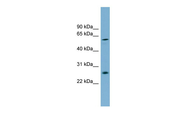WB - BIVM antibody - middle region AI14046