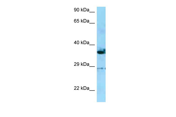 WB - INF2 antibody - C-terminal region AI15001