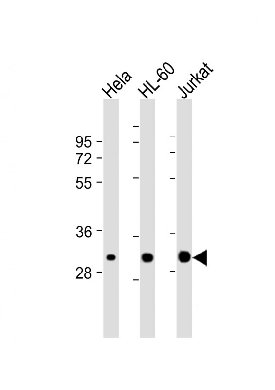 All lanes : Anti-CDK2 Antibody at 1:2000 dilutionLane 1: Hela whole cell lysateLane 2: HL-60 whole cell lysateLane 3: Jurkat whole cell lysateLysates/proteins at 20 ?g per lane. SecondaryGoat Anti-mouse IgG,  (H+L), Peroxidase conjugated at 1/10000 dilution. Predicted band size : 34 kDaBlocking/Dilution buffer: 5% NFDM/TBST.