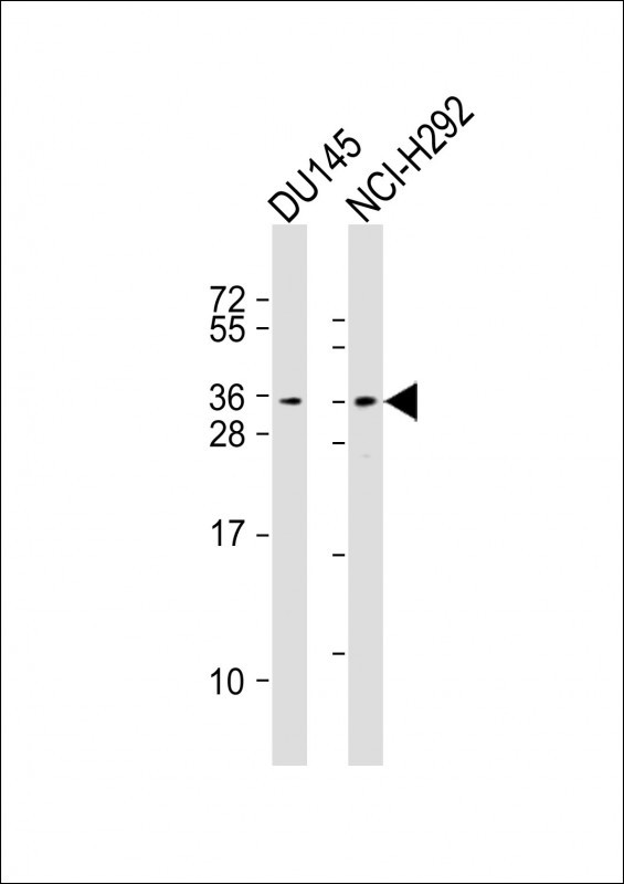 WB - TSPAN18 Antibody (Center) AP18147c