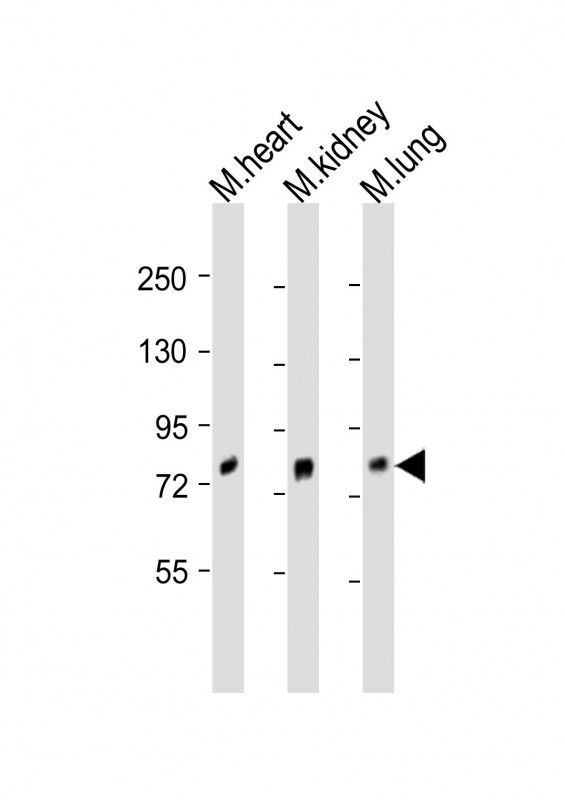 WB - MOUSE Brd7 Antibody (Center) AP20823c