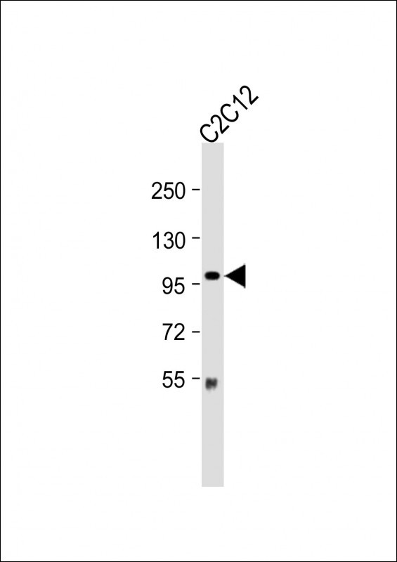 WB - Mouse Myocd Antibody (C-term) AP20988c