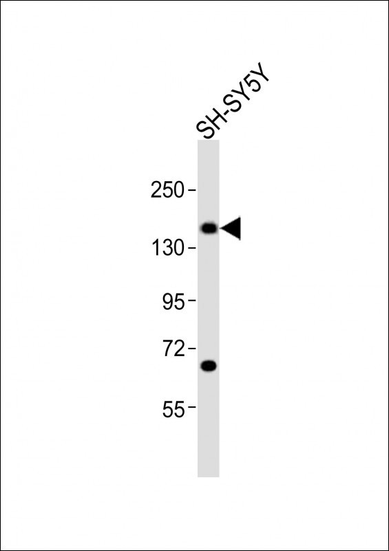 Anti-CTCF Antibody (N-Term)at  1:2000 dilution + SH-SY5Y whole cell lysatesLysates/proteins at 20 �g per lane. SecondaryGoat Anti-Rabbit IgG,  (H+L), Peroxidase conjugated at 1/10000 dilutionPredicted band size : 83 kDaBlocking/Dilution buffer: 5% NFDM/TBST.