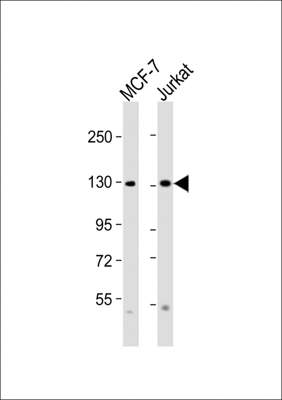 All lanes : Anti-CTCF Antibody (Center) at 1:2000 dilutionLane 1: MCF-7 whole cell lysatesLane 2: Jurkat whole cell lysatesLysates/proteins at 20 �g per lane. SecondaryGoat Anti-Rabbit IgG,  (H+L), Peroxidase conjugated at 1/10000 dilutionPredicted band size : 83 kDaBlocking/Dilution buffer: 5% NFDM/TBST.