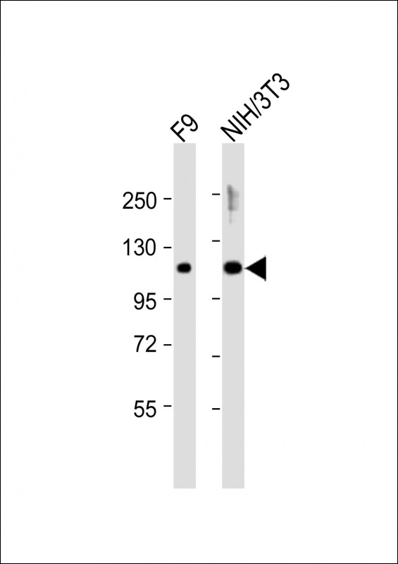 All lanes : Anti-Dnmt3b Antibody (Center) at 1:2000 dilutionLane 1: F9 whole cell lysatesLane 2: NIH/3T3 whole cell lysatesLysates/proteins at 20 �g per lane. SecondaryGoat Anti-Rabbit IgG,  (H+L), Peroxidase conjugated at 1/10000 dilutionPredicted band size : 97 kDaBlocking/Dilution buffer: 5% NFDM/TBST.