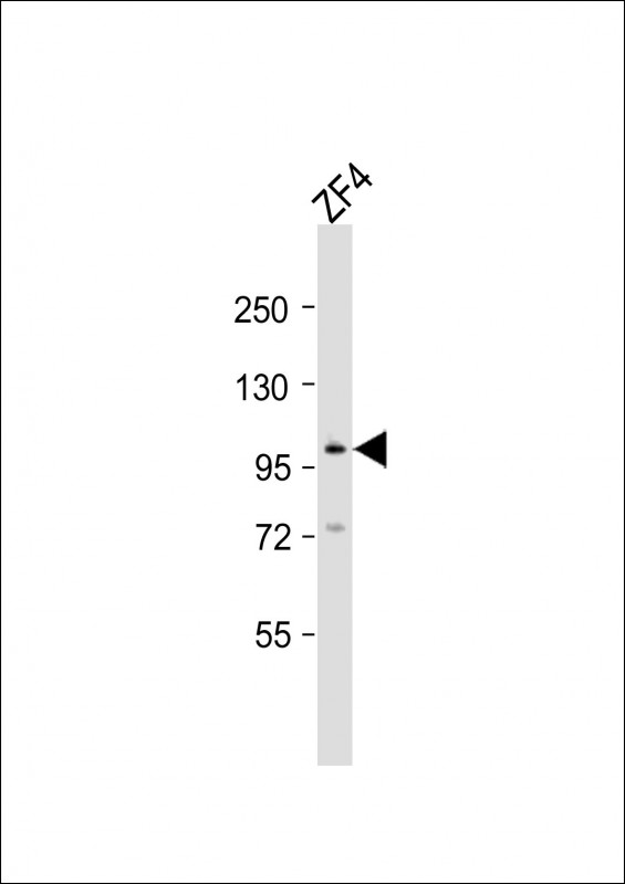 Anti-atg9a Antibody (C-Term)at  1:2000 dilution + ZF4 whole cell lysatesLysates/proteins at 20 �g per lane. SecondaryGoat Anti-Rabbit IgG,  (H+L), Peroxidase conjugated at 1/10000 dilutionPredicted band size : 96 kDaBlocking/Dilution buffer: 5% NFDM/TBST.