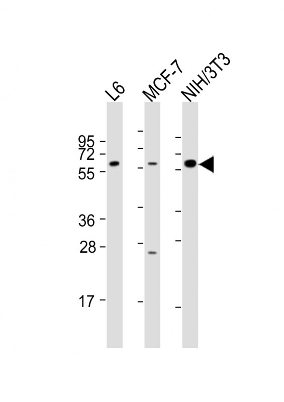 All lanes : Anti-YES1 Antibody (N-term) at 1:2000 dilutionLane 1: L6 whole cell lysatesLane 2: MCF-7 whole cell lysatesLane 3: NIH/3T3 whole cell lysatesLysates/proteins at 20 �g per lane. SecondaryGoat Anti-Rabbit IgG,  (H+L), Peroxidase conjugated at 1/10000 dilutionPredicted band size : 61 kDaBlocking/Dilution buffer: 5% NFDM/TBST.