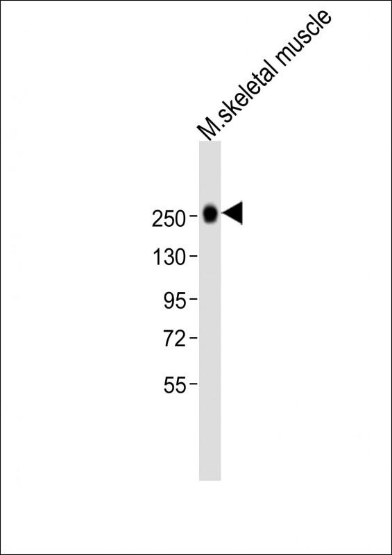 WB - MYH1 Antibody (N-term) AP21531a