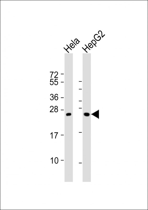 All lanes : Anti-GSTT1 Antibody (C-term) at 1:2000 dilutionLane 1: Hela whole cell lysatesLane 2: HepG2 whole cell lysatesLysates/proteins at 20 �g per lane. SecondaryGoat Anti-Rabbit IgG,  (H+L), Peroxidase conjugated at 1/10000 dilutionPredicted band size : 27 kDaBlocking/Dilution buffer: 5% NFDM/TBST.
