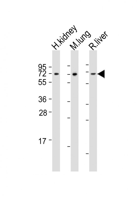 All lanes : Anti-ACSF2 Antibody (Center) at 1:2000 dilutionLane 1: human kidney lysatesLane 2: mouse lung lysatesLane 3: rat liver lysatesLysates/proteins at 20 �g per lane. SecondaryGoat Anti-Rabbit IgG,  (H+L), Peroxidase conjugated at 1/10000 dilutionPredicted band size : 68 kDaBlocking/Dilution buffer: 5% NFDM/TBST.