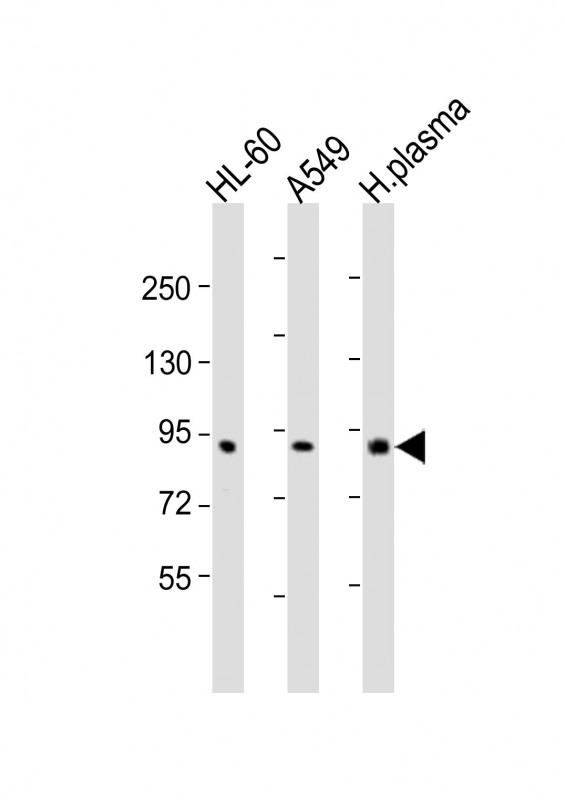 All lanes : Anti-F2 Antibody (N-Term) at 1:2000 dilutionLane 1: HL-60 whole cell lysatesLane 2: A549 whole cell lysatesLane 3: human plasma lysatesLysates/proteins at 20 �g per lane. SecondaryGoat Anti-Rabbit IgG,  (H+L), Peroxidase conjugated at 1/10000 dilution. Predicted band size : 70 kDaBlocking/Dilution buffer: 5% NFDM/TBST.