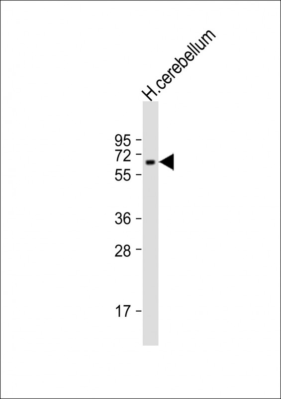 Anti-SPPL2B Antibody (Center)at  1:2000 dilution + human cerebellum lysatesLysates/proteins at 20 �g per lane. SecondaryGoat Anti-Rabbit IgG,  (H+L), Peroxidase conjugated at 1/10000 dilution. Predicted band size : 65 kDaBlocking/Dilution buffer: 5% NFDM/TBST.