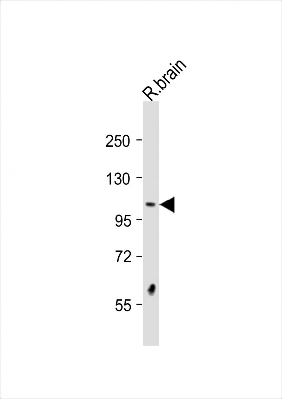 WB - DSTYK Antibody (N-Term) AP21613a