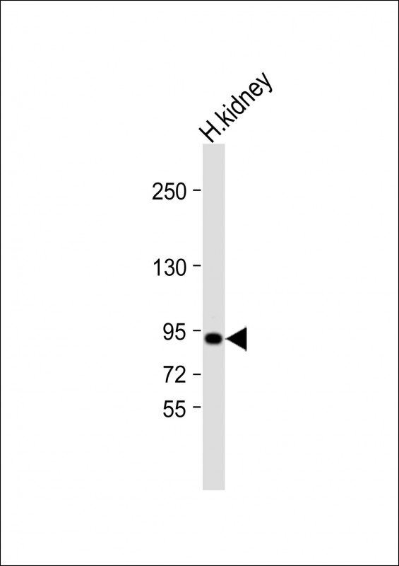 Anti-VAV3 Antibody (Cterm) at  1:2000 dilution + human kidney lysateLysates/proteins at 20 �g per lane. SecondaryGoat Anti-Rabbit IgG,  (H+L), Peroxidase conjugated at 1/10000 dilution. Predicted band size : 98 kDaBlocking/Dilution buffer: 5% NFDM/TBST.
