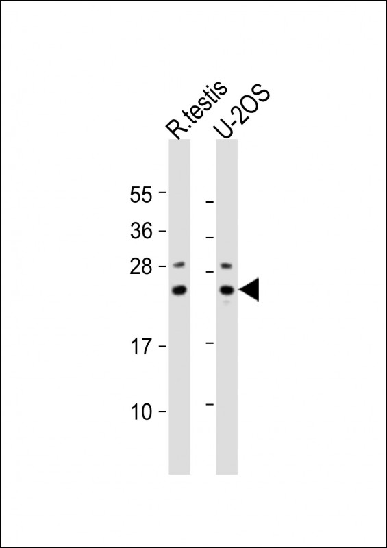 All lanes : Anti-PSMB9 Antibody (CTerm) at 1:2000 dilutionLane 1: rat testis lysateLane 2: U-2OS whole cell lysateLysates/proteins at 20 �g per lane. SecondaryGoat Anti-Rabbit IgG,  (H+L), Peroxidase conjugated at 1/10000 dilution. Predicted band size : 23 kDaBlocking/Dilution buffer: 5% NFDM/TBST.