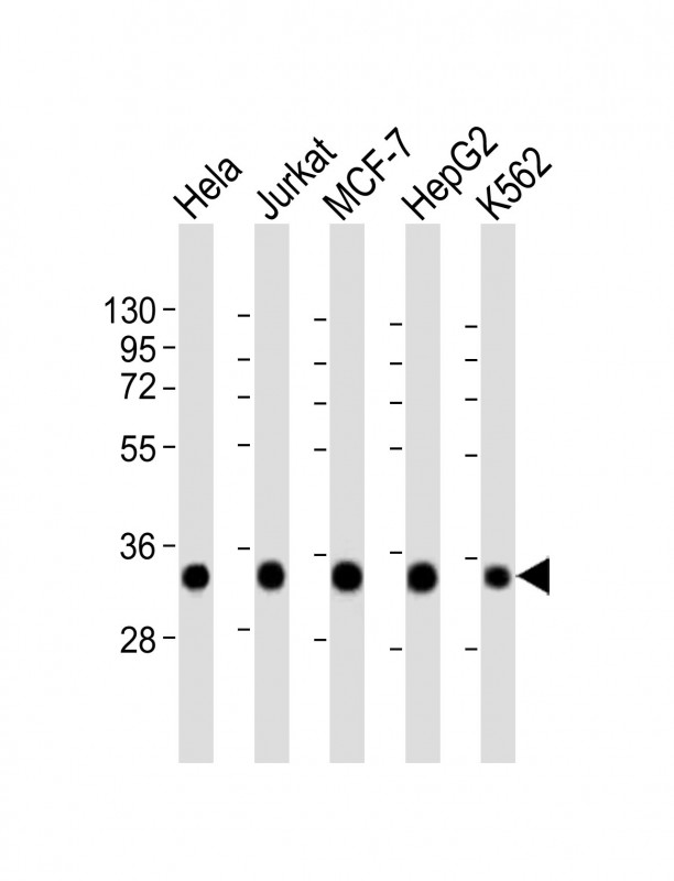 All lanes : Anti-HNRNPA1L2 Antibody (N-Term) at 1:2000 dilutionLane 1: Hela whole cell lysateLane 2: Jurkat whole cell lysateLane 3: MCF-7 whole cell lysateLane 4: HepG2 whole cell lysateLane 5: K562 whole cell lysateLysates/proteins at 20 �g per lane. SecondaryGoat Anti-Rabbit IgG,  (H+L), Peroxidase conjugated at 1/10000 dilution. Predicted band size : 34 kDaBlocking/Dilution buffer: 5% NFDM/TBST.