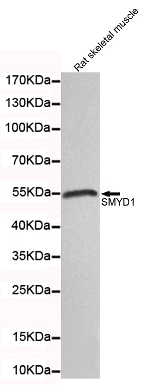 WB - SMYD1 Antibody AP52666